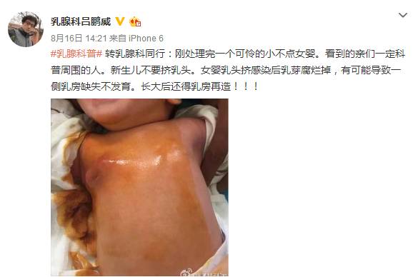 为什么说母乳宝宝更聪明？关于喂奶，这篇全搞定
